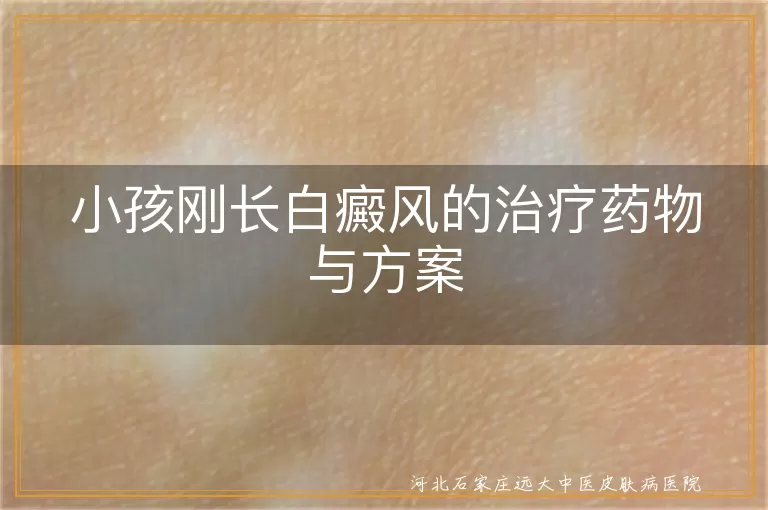 小孩白癜风,治疗药物,治疗方案,光疗,移植治疗,心理治疗,日常护理