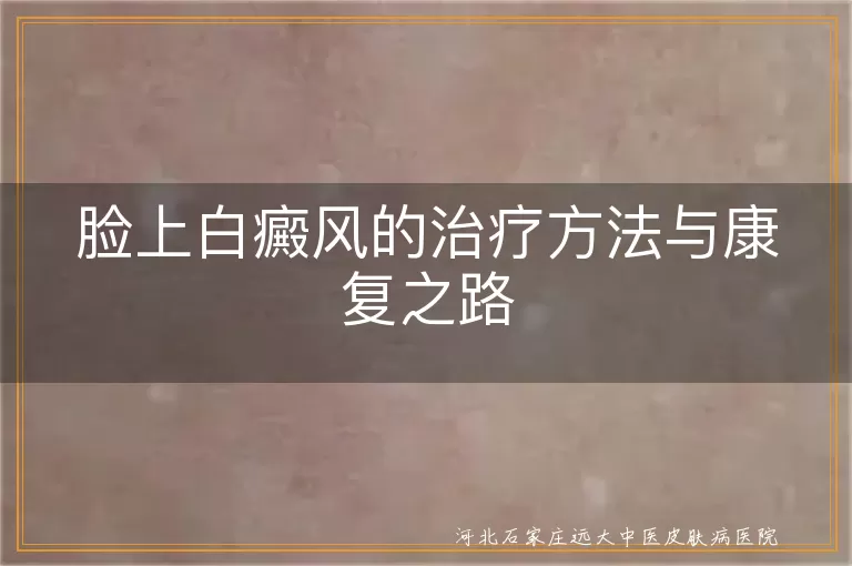 脸上白癜风,治疗方法,康复之路,药物治疗,光疗,手术治疗,中医治疗,饮食调理,日常护理,心理调适