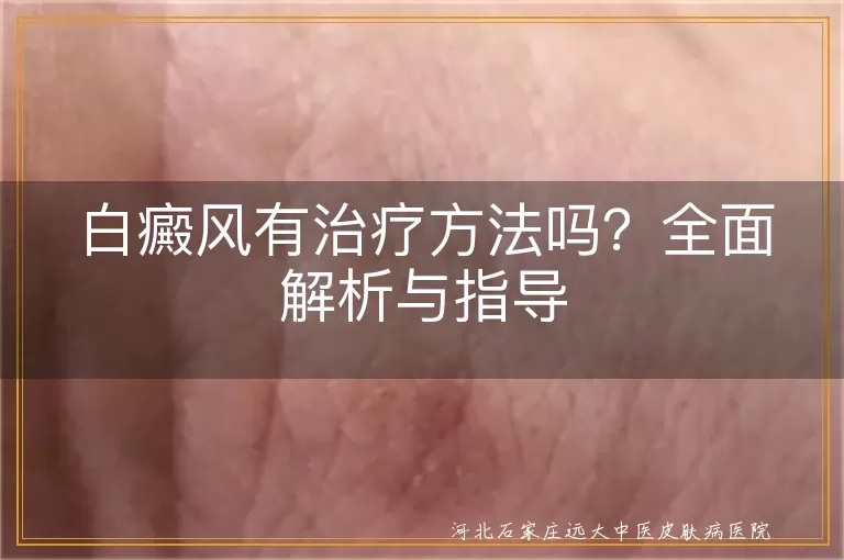 白癜风,治疗方法,药物治疗,光疗,手术治疗,日常调理,饮食调养