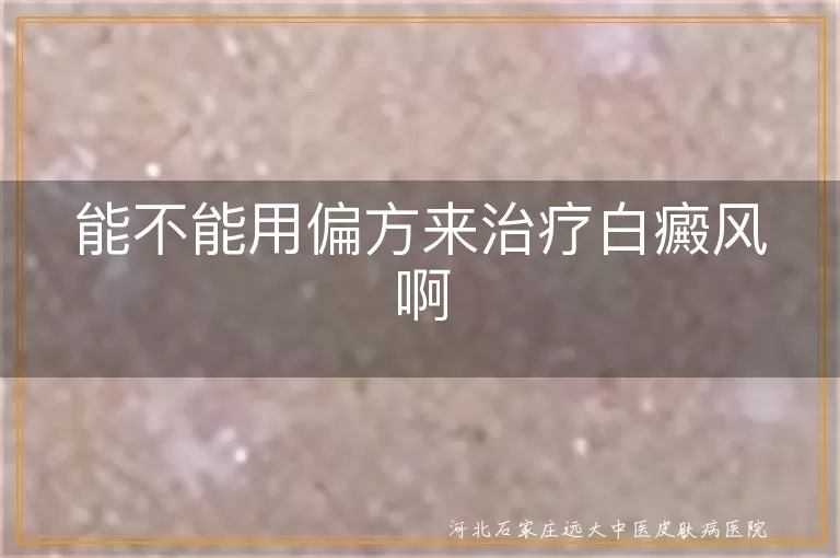能不能用偏方来治疗白癜风啊