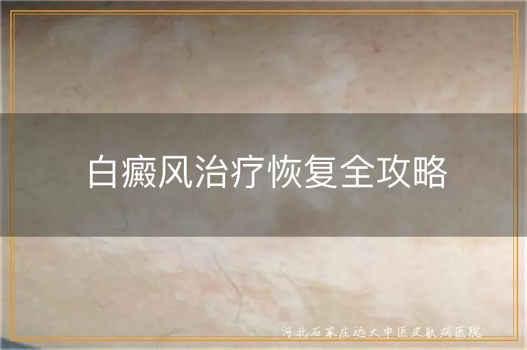 白癜风治疗恢复全攻略