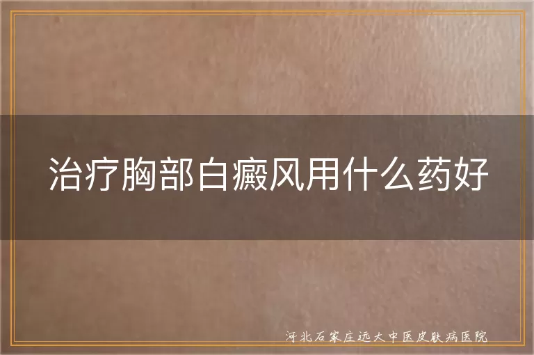 治疗胸部白癜风用什么药好