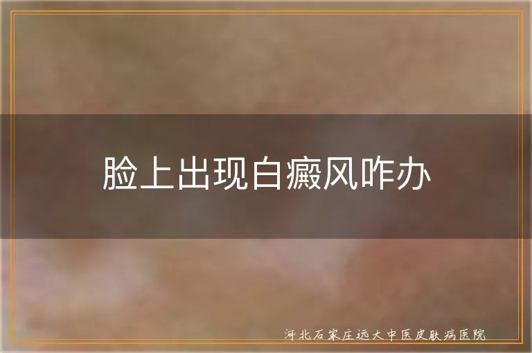 脸上出现白癜风咋办
