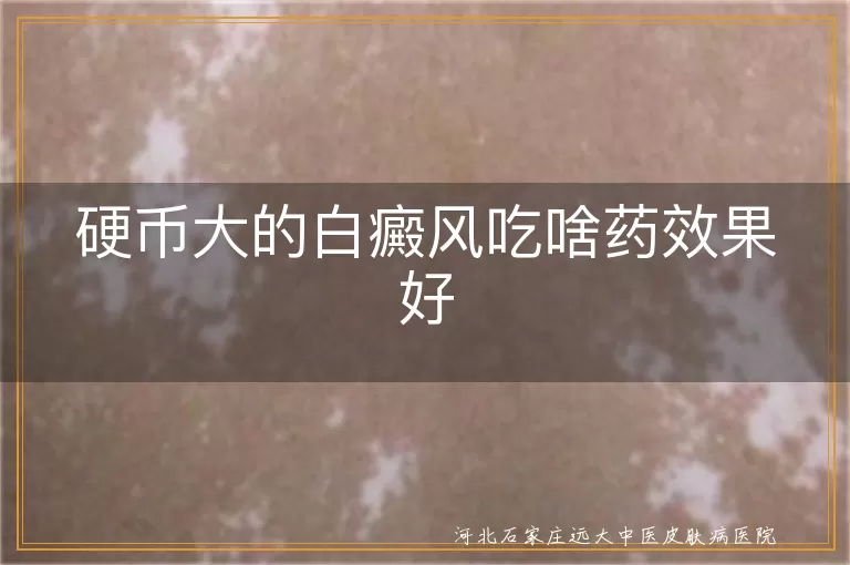 硬币大的白癜风吃啥药效果好