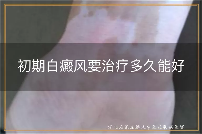 初期白癜风治疗时间, 白癜风康复周期, 白斑治疗多久能好, 白癜风治疗影响因素