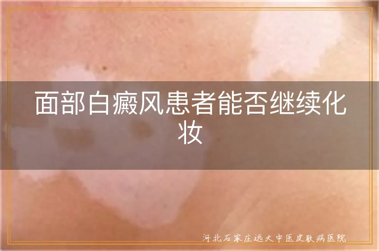 面部白癜风患者能否继续化妆