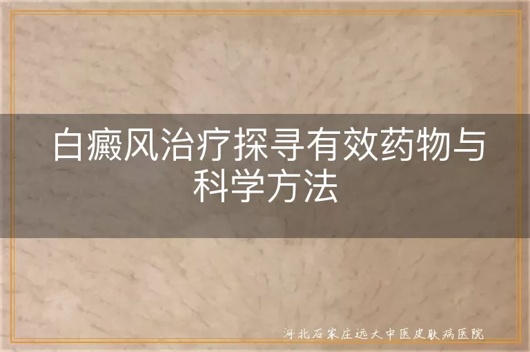 白癜风治疗药物, 白癜风光疗方法, 白癜风手术治疗, 白斑科学治疗