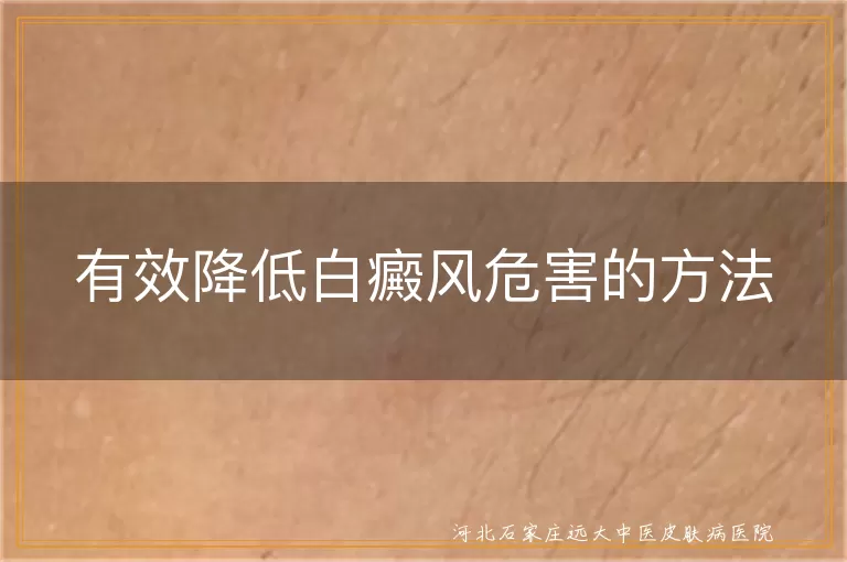 有效降低白癜风危害的方法