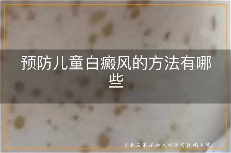 预防儿童白癜风的方法有哪些