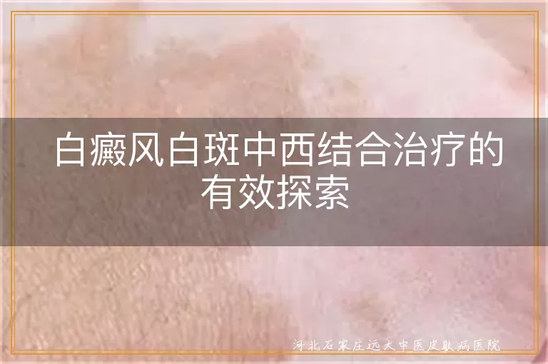 白癜风白斑中西结合治疗的有效探索