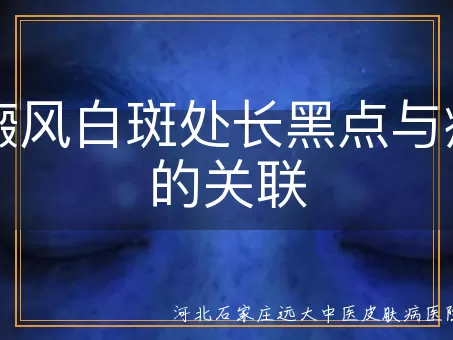 白癜风白斑处长黑点与痊愈的关联