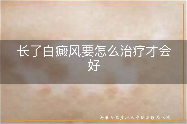 长了白癜风要怎么治疗才会好