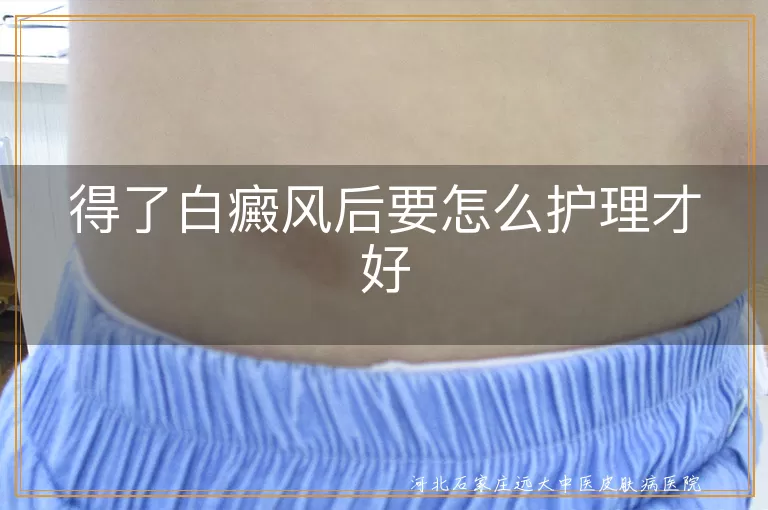 得了白癜风后要怎么护理才好
