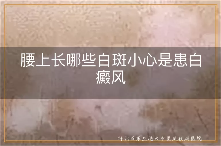 腰上长哪些白斑小心是患白癜风