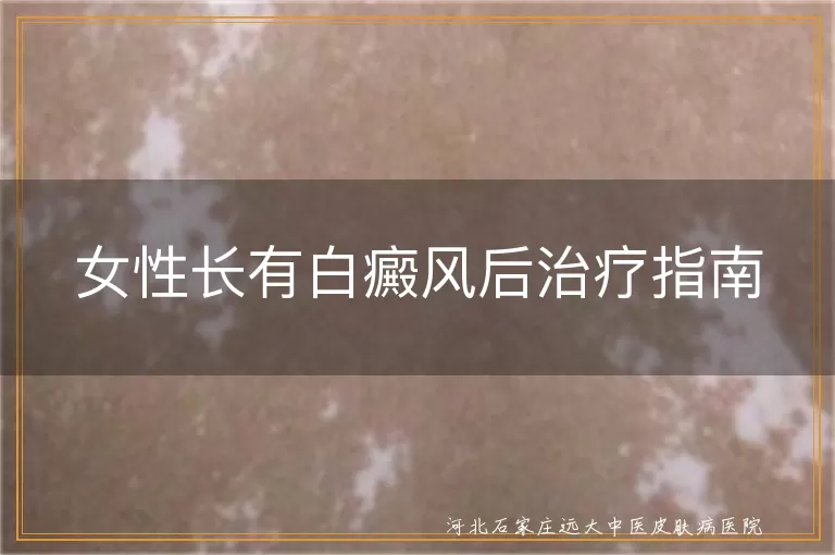 女性长有白癜风后治疗指南