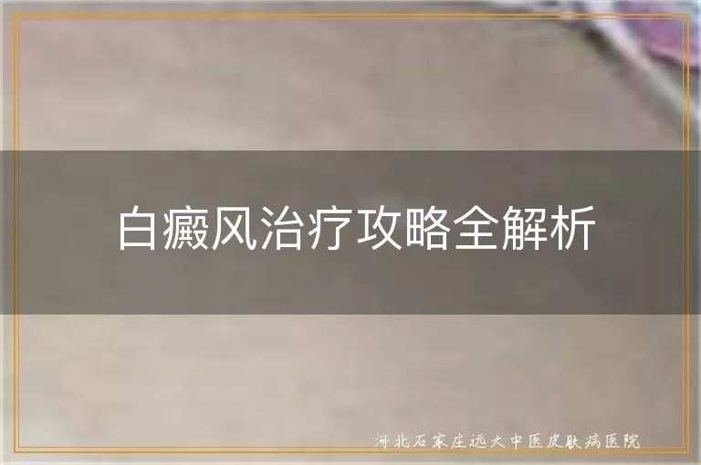 白癜风治疗攻略全解析