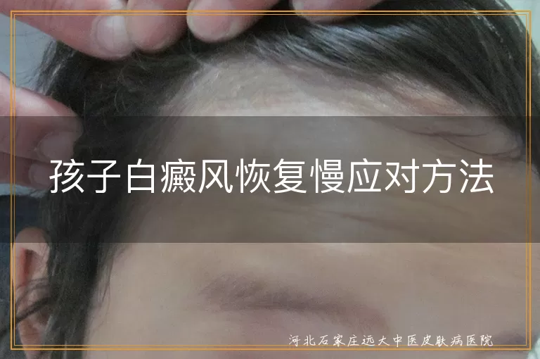 孩子白癜风恢复慢应对方法