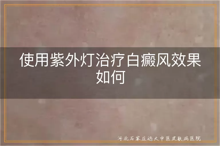 使用紫外灯治疗白癜风效果如何