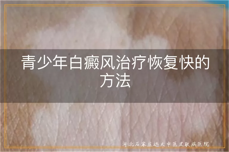 青少年白癜风治疗恢复快的方法