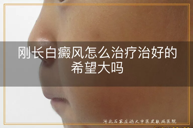 刚长白癜风如何治疗,白癜风早期治愈希望,白斑治疗方法选择,白癜风能否治好