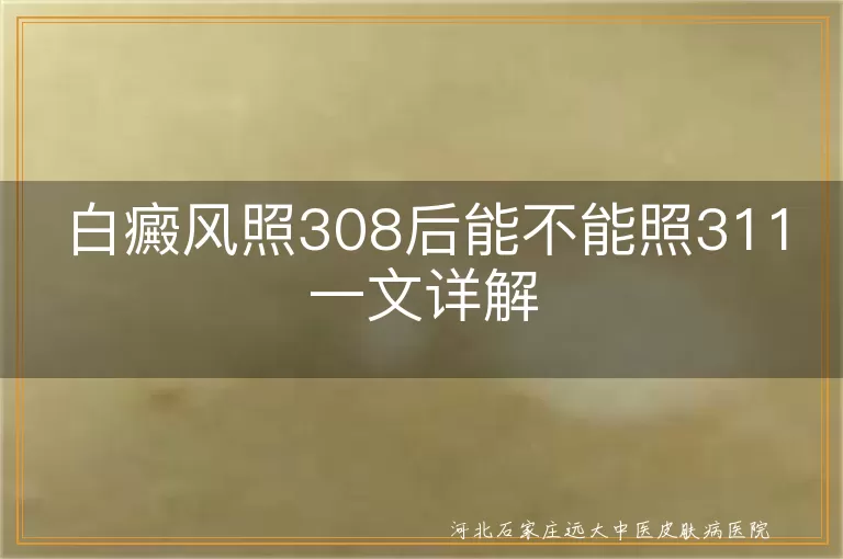 白癜风照308后能不能照311一文详解