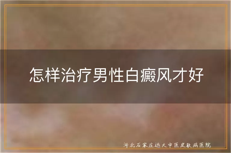 怎样治疗男性白癜风才好