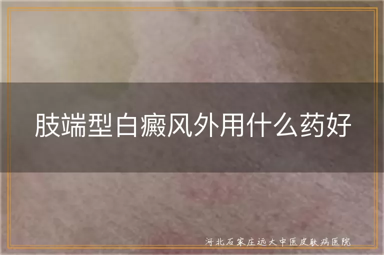 肢端型白癜风外用什么药好