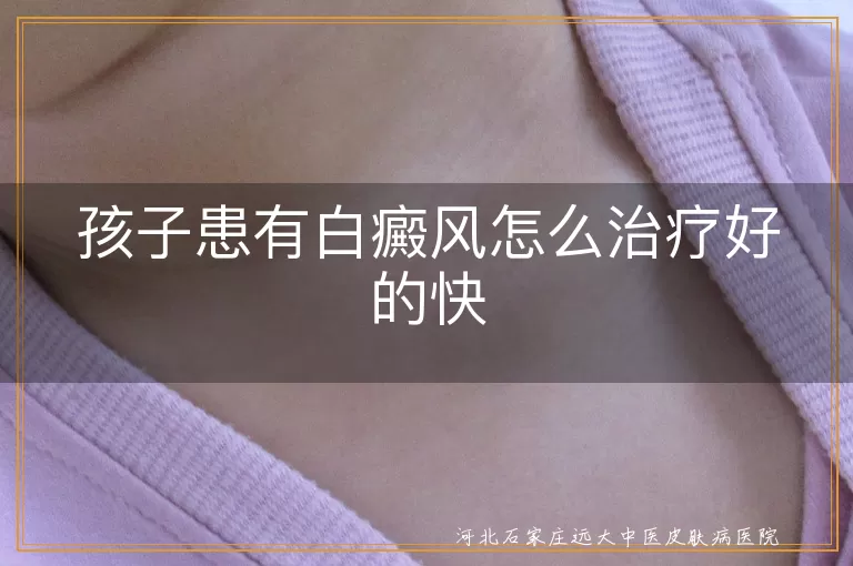 孩子患有白癜风怎么治疗好的快