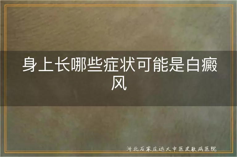 身上长哪些症状可能是白癜风