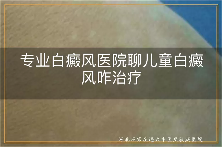 专业白癜风医院聊儿童白癜风咋治疗