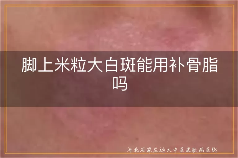 脚上米粒大白斑能用补骨脂吗