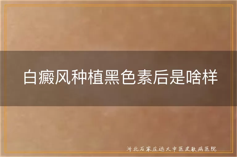 白癜风种植黑色素后是啥样