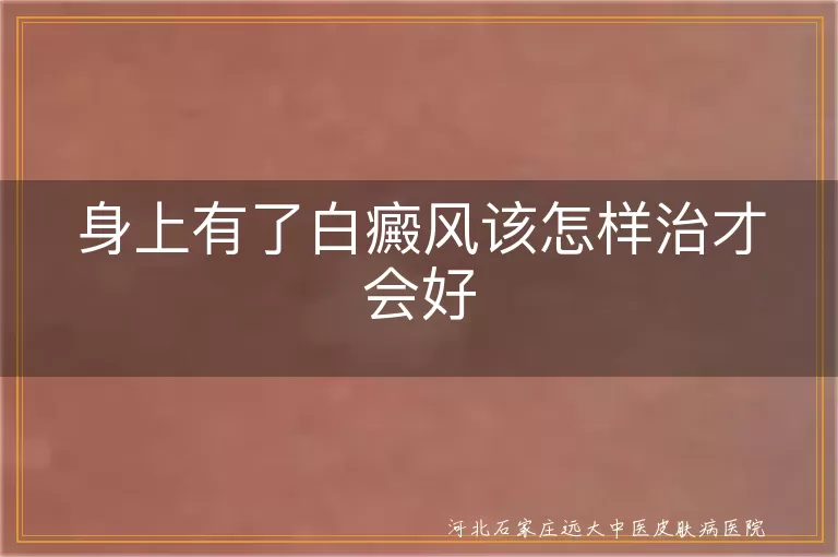 身上有了白癜风该怎样治才会好