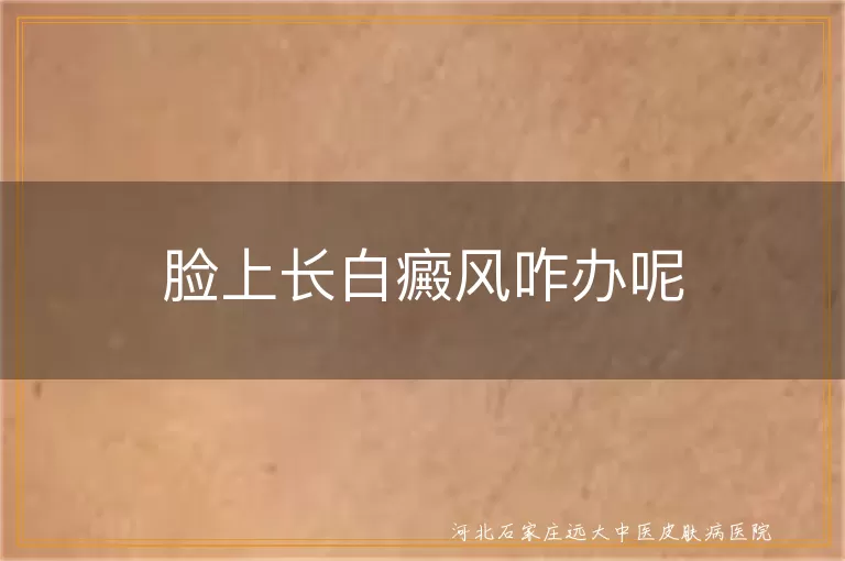 脸上长白癜风咋办呢