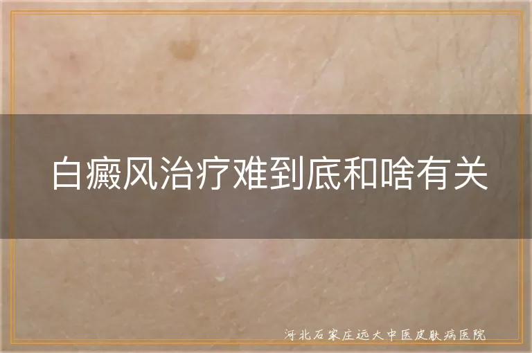 白癜风治疗难到底和啥有关