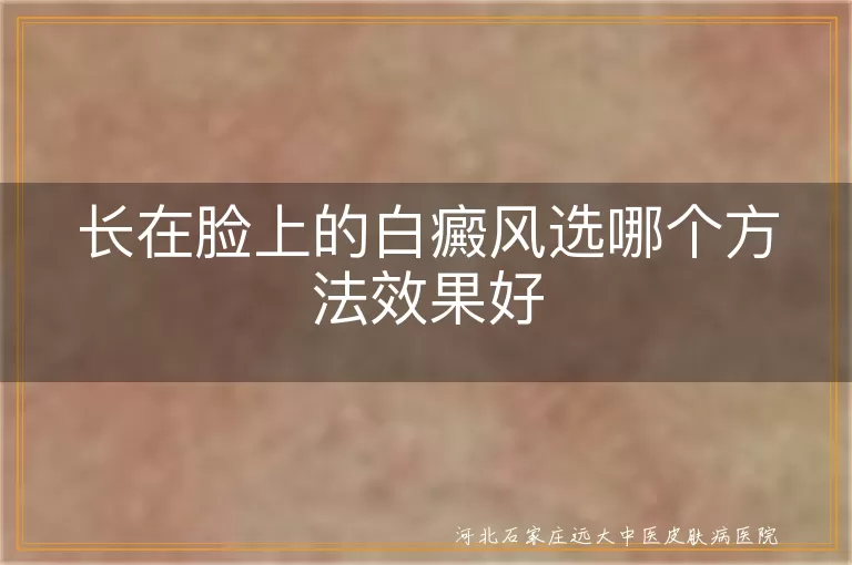 长在脸上的白癜风选哪个方法效果好