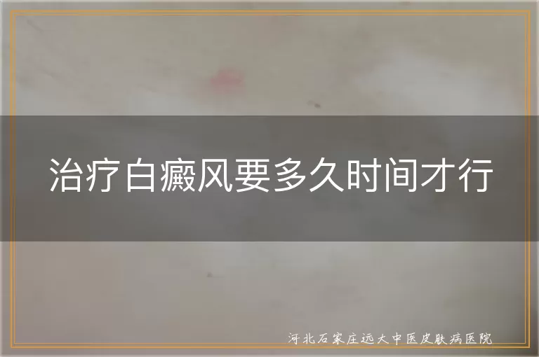 白癜风治疗周期多长,白斑恢复时间快慢,白癜风康复需要多久