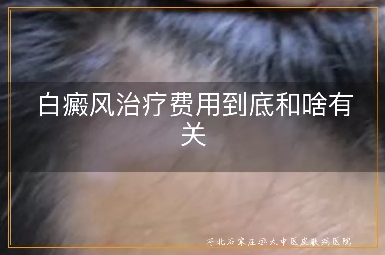 白癜风治疗费用因素,白斑病情严重程度影响,白癜风治疗周期与费用