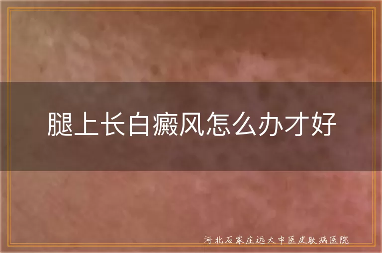 腿上白癜风治疗方法,白癜风药物治疗,白斑光疗效果