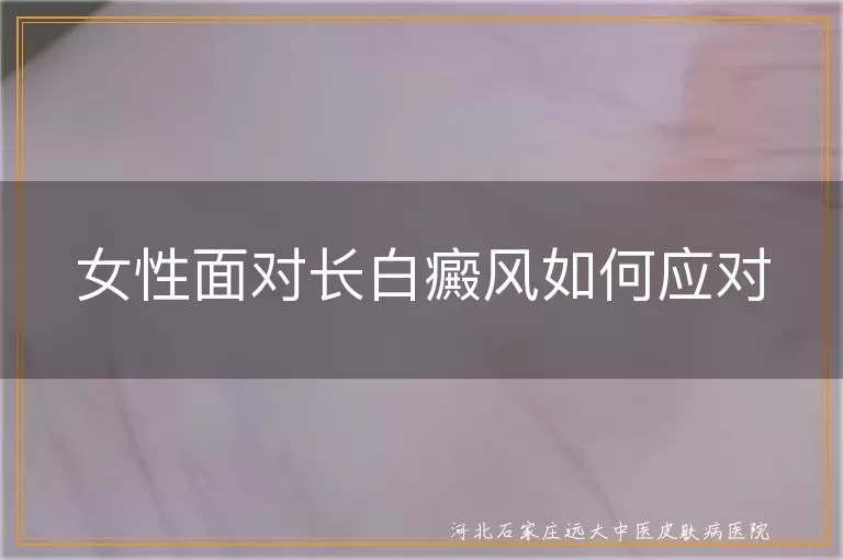 女性白癜风治疗方法,白斑生活调理建议,白癜风心理调适技巧