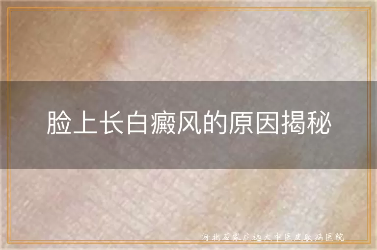 白癜风原因探究,脸上白斑揭秘,白癜风预防方法