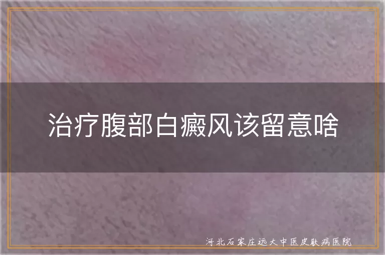 腹部白癜风治疗方法,白癜风饮食生活注意事项,白癜风皮肤保护要点