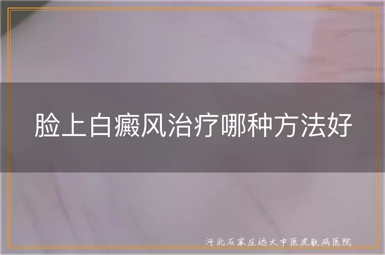 脸上白癜风药物治疗,白癜风光疗效果,白癜风手术治疗选择