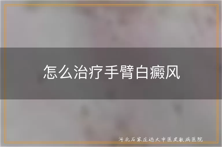 怎么治疗手臂白癜风