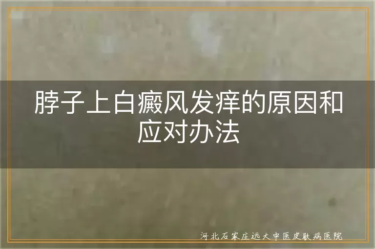 白癜风发痒原因及应对,白斑处瘙痒怎么办,白癜风脖子痒怎么回事