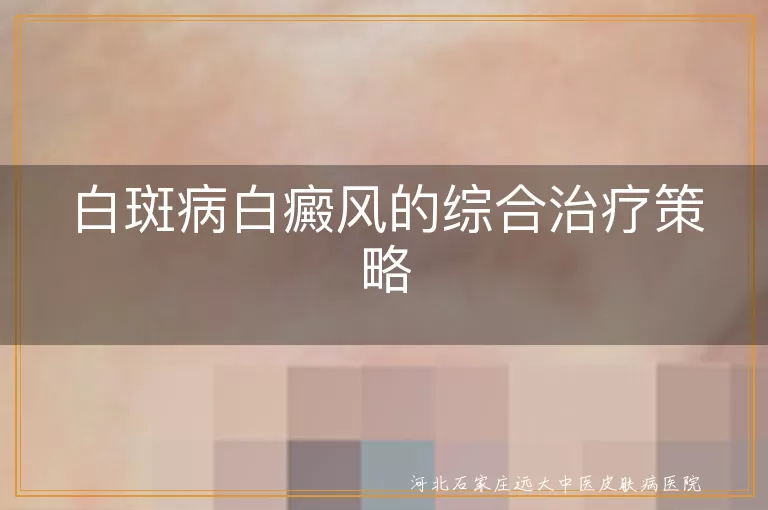 白癜风综合治疗手段,白斑病综合疗法,白癜风多种治疗方法