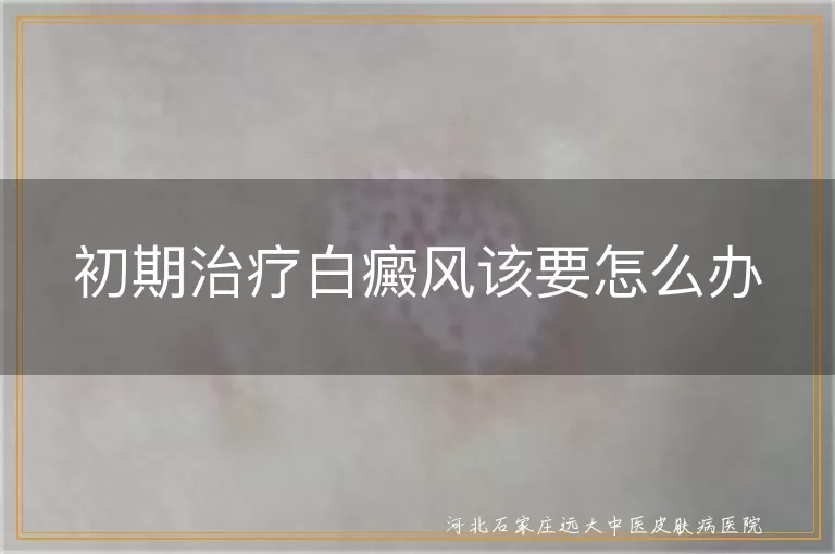 初期治疗白癜风该要怎么办