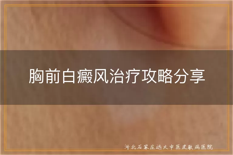 胸前白癜风治疗方法,白癜风光疗效果,白斑中医治疗