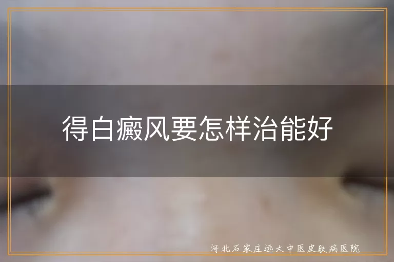 白癜风科学治疗方法,白癜风生活调理建议,白癜风预防复发措施
