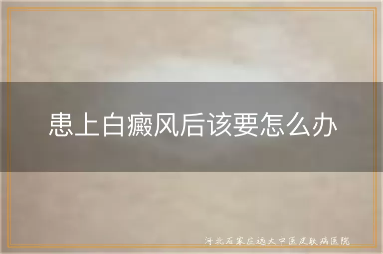 白癜风治疗方法,白斑心理调适,预防白癜风复发